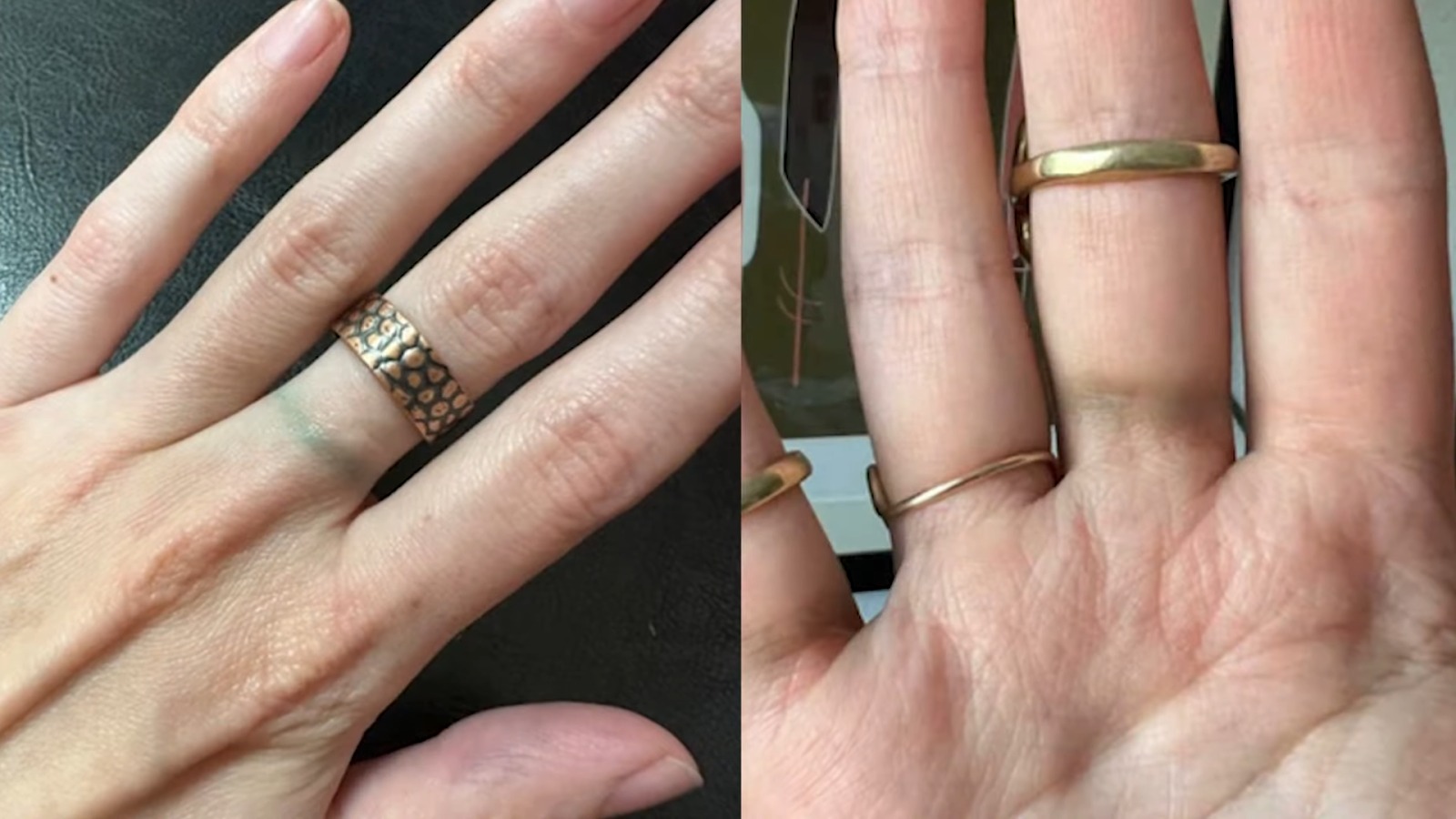 چرا پوست بدن با طلا سبز می‌شود؟ بررسی دلایل و راه‌های جلوگیری