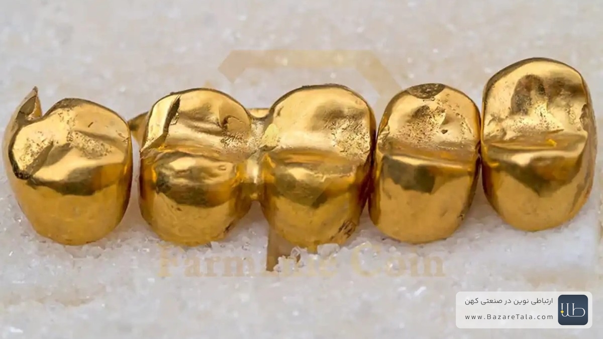 کاربرد طلا در دندانپزشکی