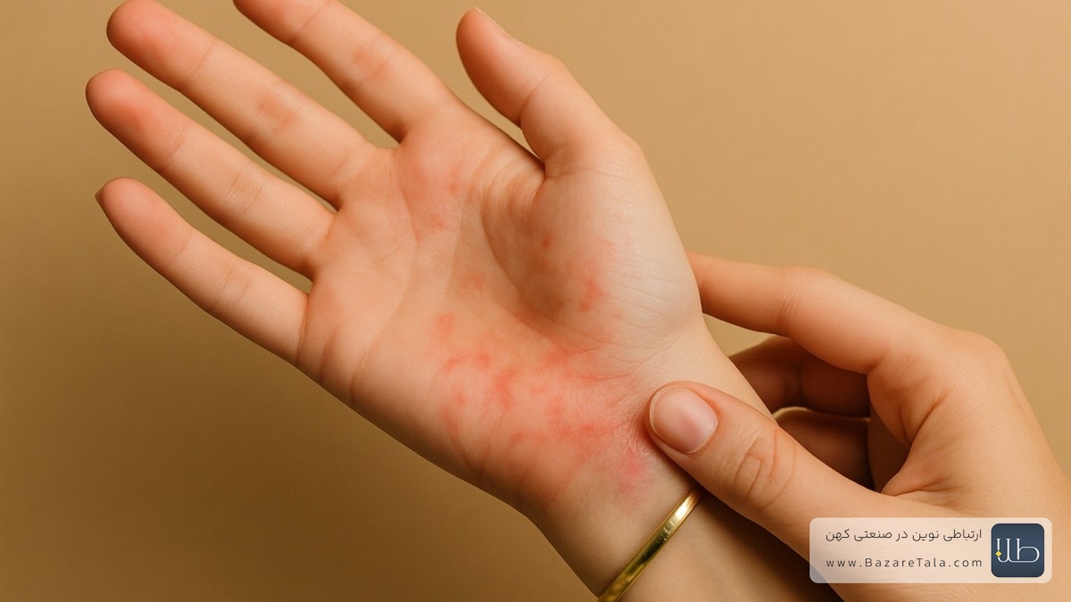 حساسیت به طلا